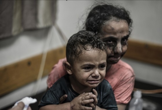 "الأونروا": أكثر من 50 ألف طفل في غزة يحتاجون للعلاج من سوء التغذية الحاد