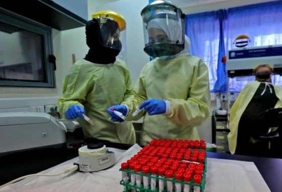 "الصحة": 24 وفاة و3648 إصابة جديدة بفيروس كورونا خلال الساعات الـ 24 الماضية