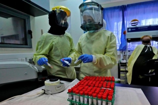 4 وفيات و593 إصابة جديدة بفيروس "كورونا" و3597 حالة تعاف