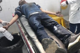اصابة شاب بانفجار جسم مشبوه من مخلفات الاحتلال في مسافر يطا جنوب الخليل