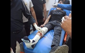 إصابة شابين بالرصاص خلال مواجهات مع الاحتلال في حوارة جنوب نابلس وعزون شرق قلقيلية