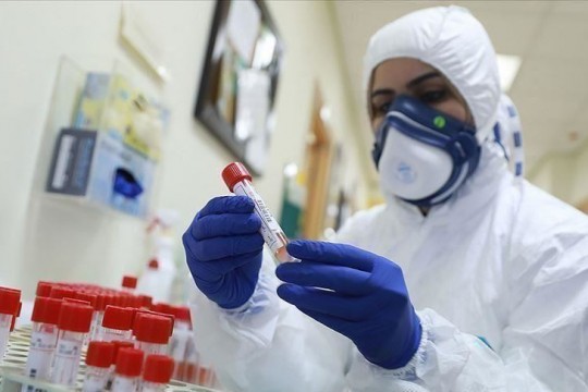 3  وفيات و252 إصابة جديدة بفيروس "كورونا" خلال الـ 24 ساعة الماضية