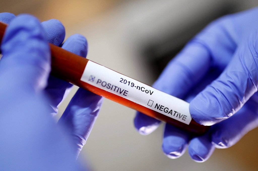 17 وفاة و2231 إصابة جديدة بفيروس "كورونا" خلال الـ 24 ساعة الماضية