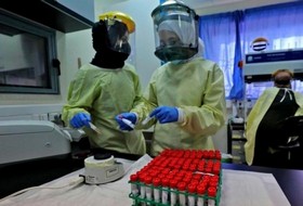9 وفيات و327 إصابة جديدة بفيروس "كورونا" و745 حالة تعافٍ