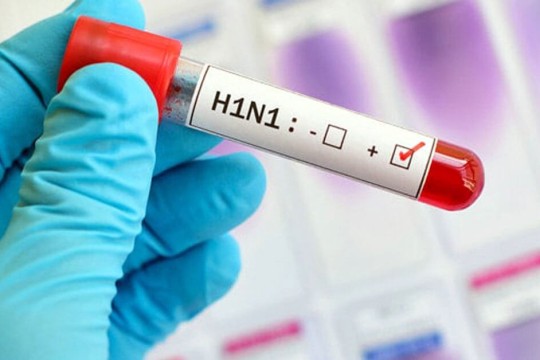 وصفة لصنع كارثة: دراسة مثيرة للجدل تكشف طريقة تعديل فيروس H5N1 للبشر